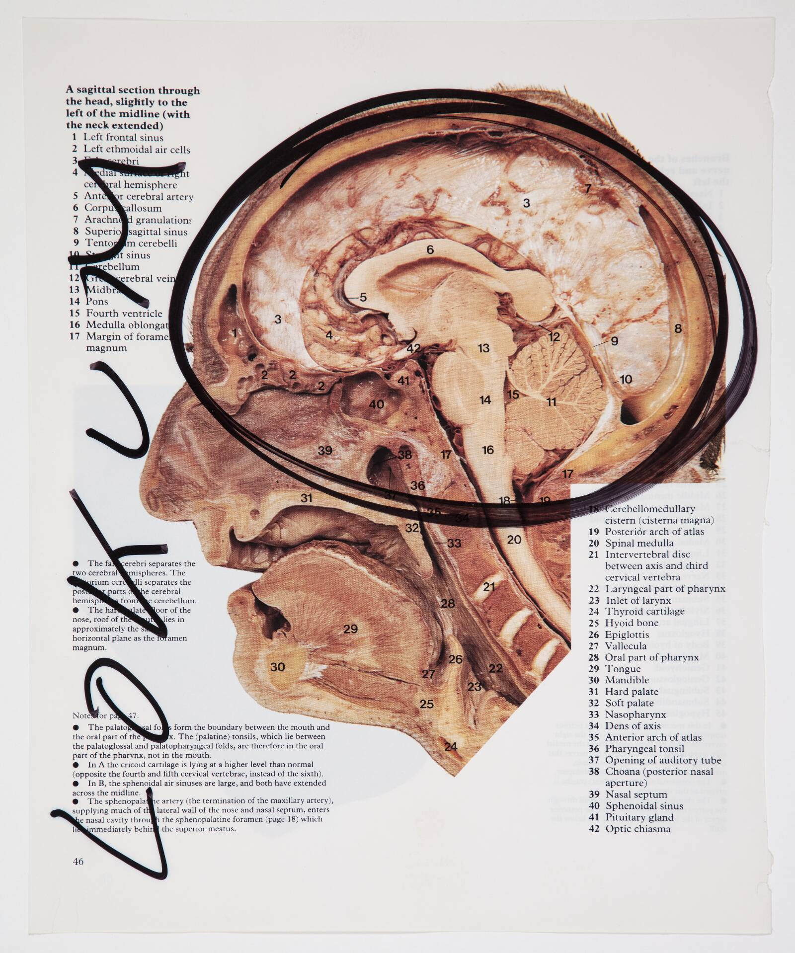 Lokum, Christian Lemmerz, 1994