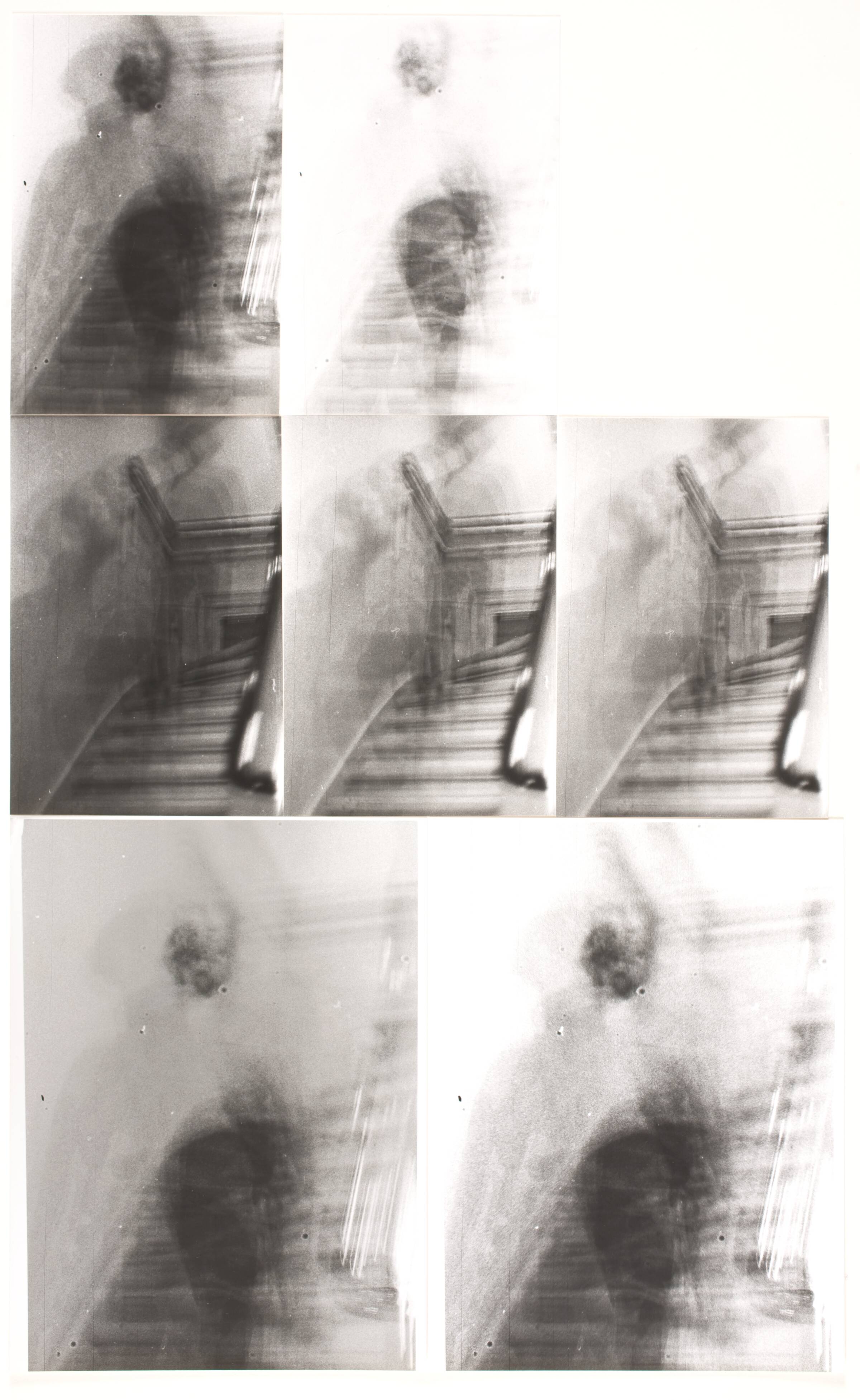 "Staircase: two - three - two", William Louis Sørensen, 1979