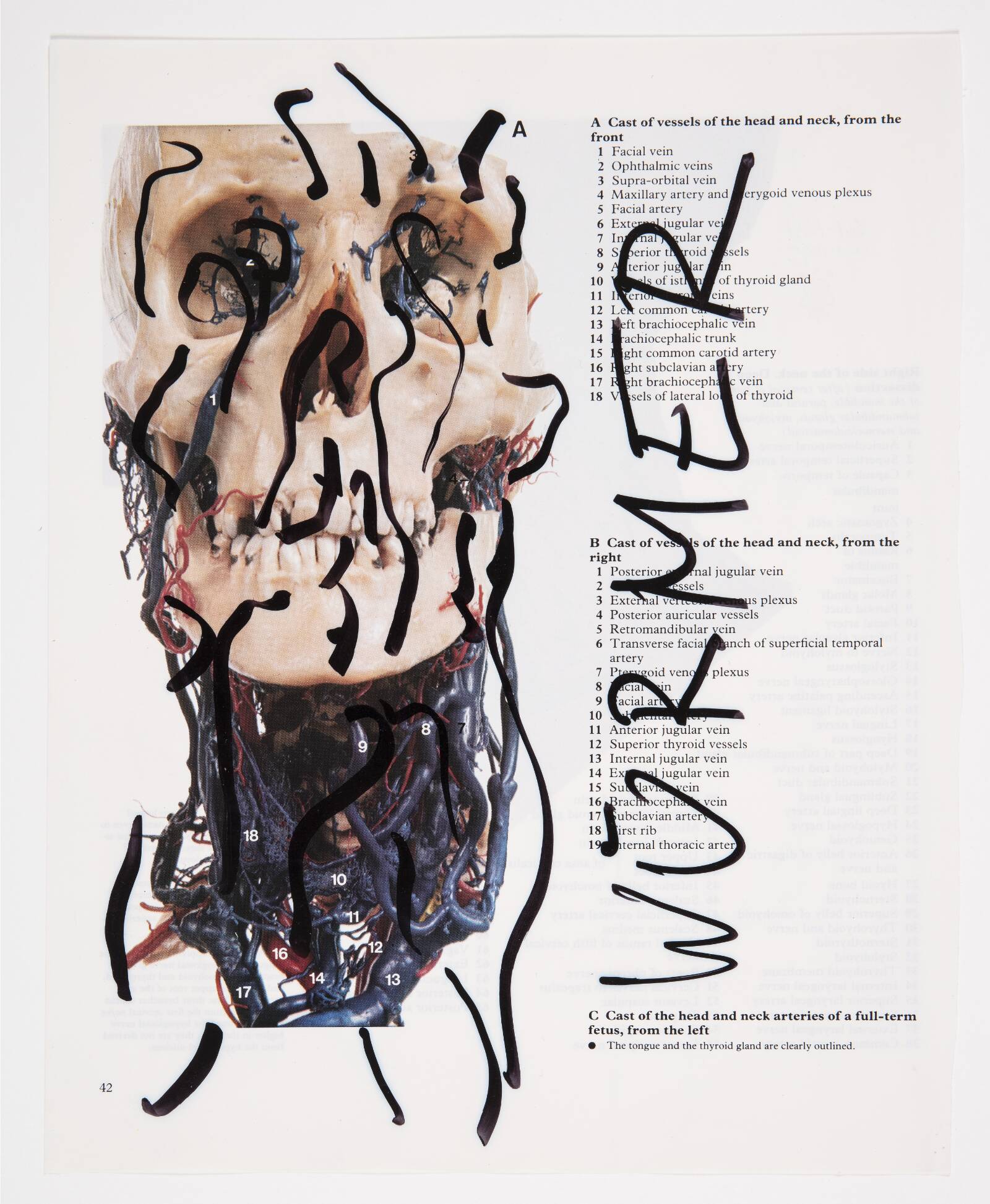 Würmer, Christian Lemmerz, 1994