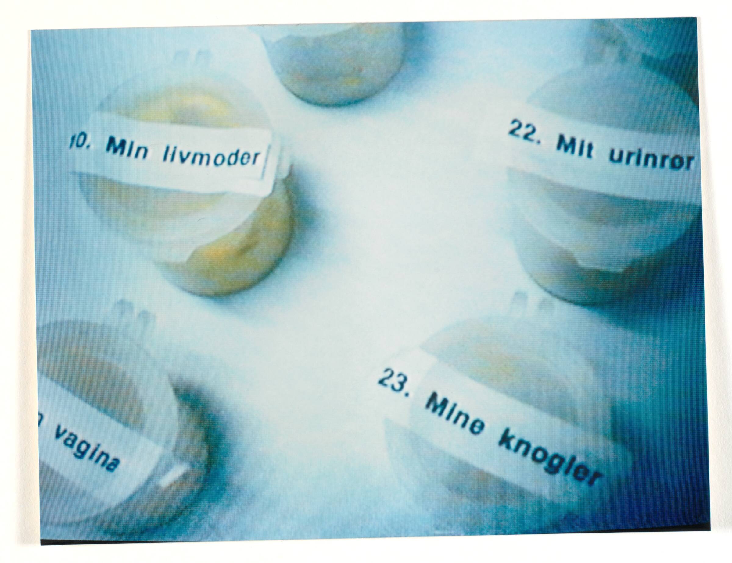 Labotik, Anja Franke, 1995