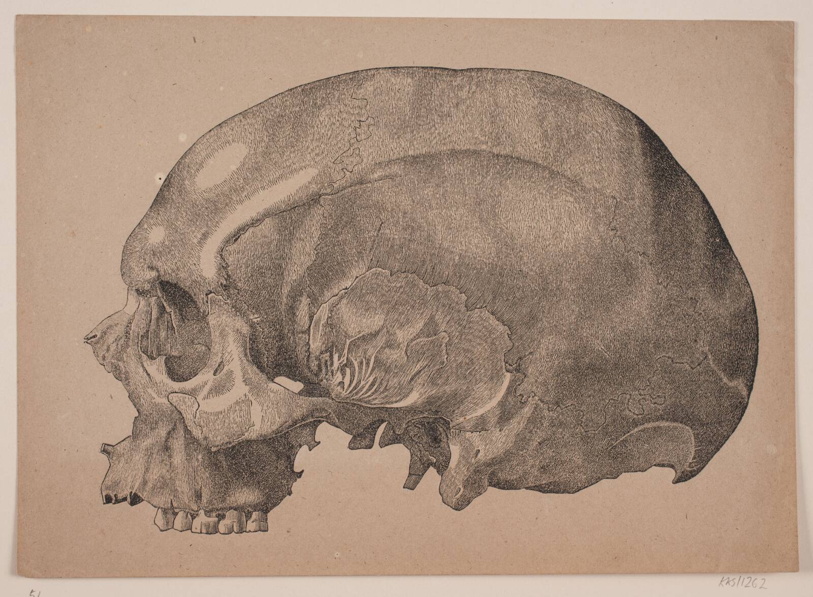 Kranium, Andreas Flinch, 1838