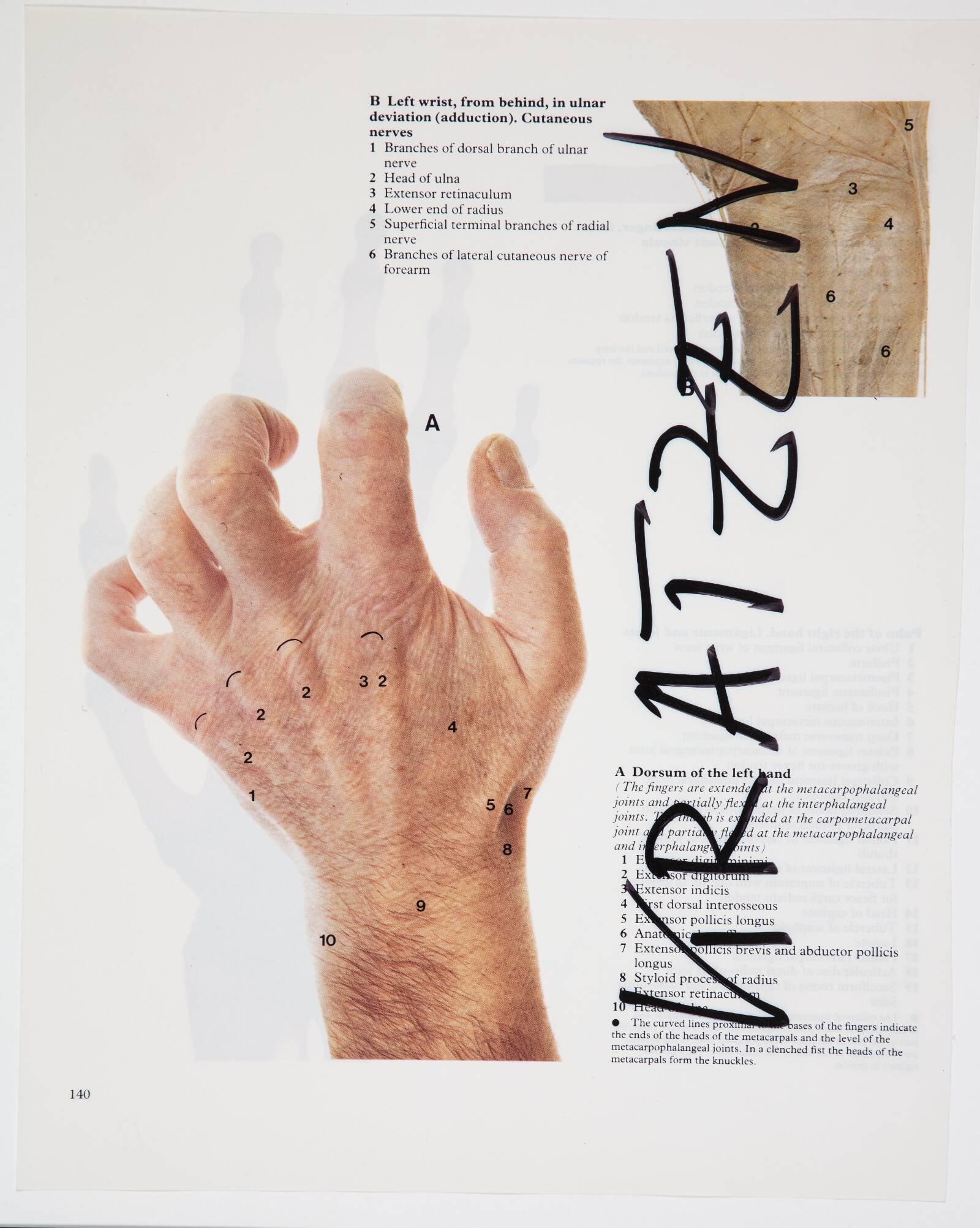 Kratzen, Christian Lemmerz, 1994