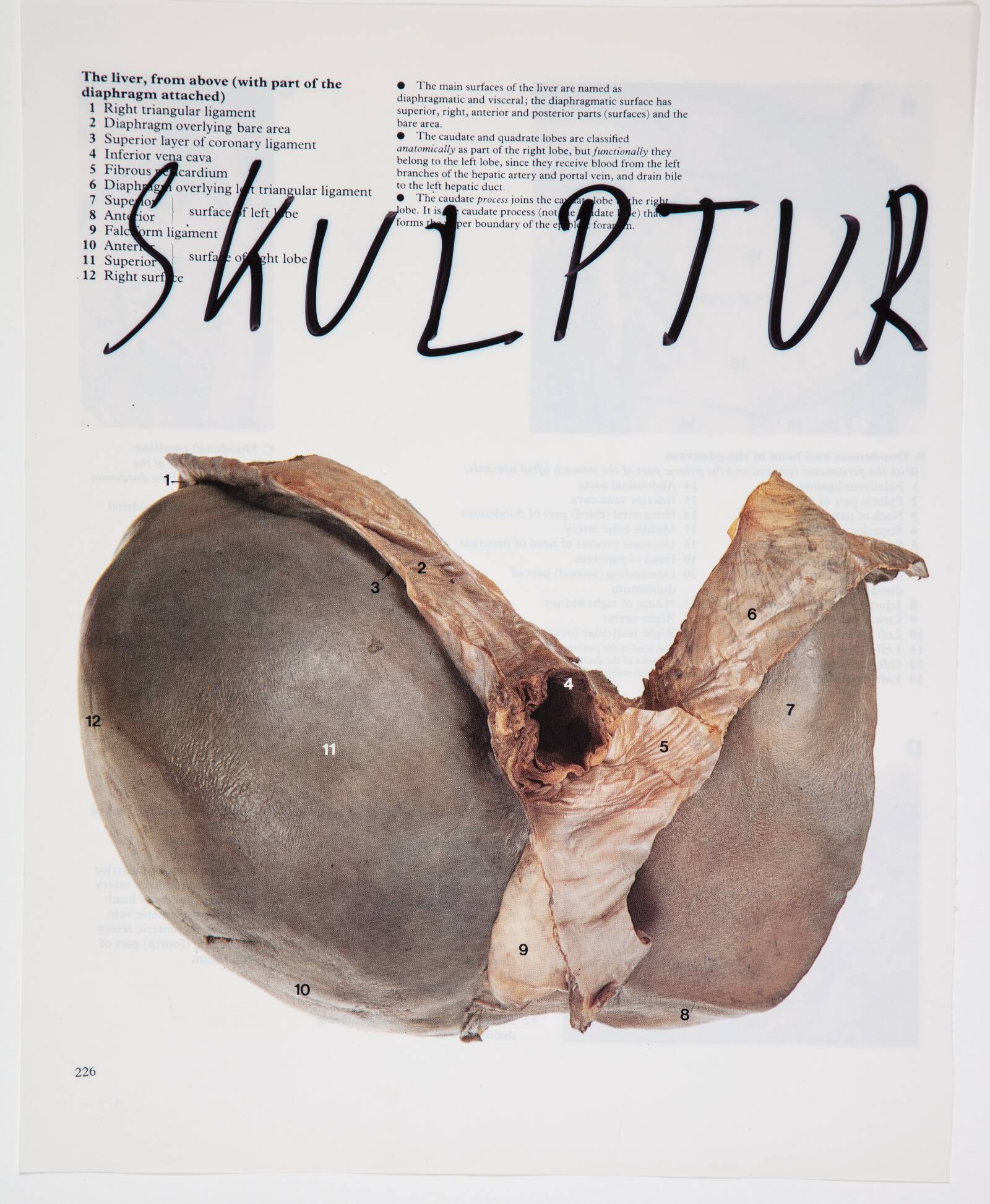 Skulptur, Christian Lemmerz, 1994
