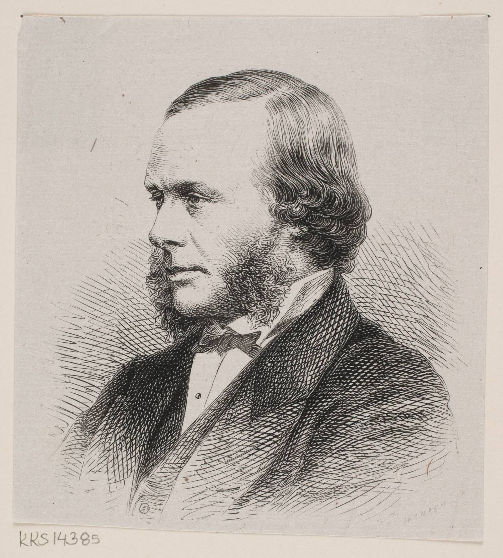 Joseph Lister, H.P. Hansen, 1876